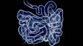 SUS adota novo exame para detectar câncer de intestino antes dos sintomas