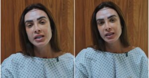 Nicole Bahls faz transplante capilar e declara: “Mais feliz”