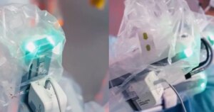 Cirurgia com robô: médico brasileiro na China opera paciente no RS