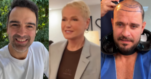 Como Xuxa Meneghel, veja famosos que fizeram transplante capilar